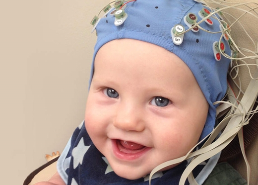 Çocuklarda Video EEG Monitorizasyonu